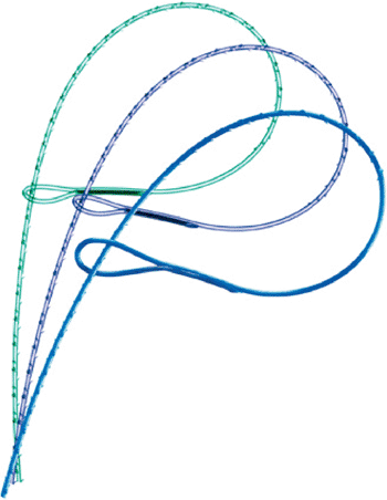 Image: The V-Loc polybutester (PBT) suture (Photo courtesy of Covidien).